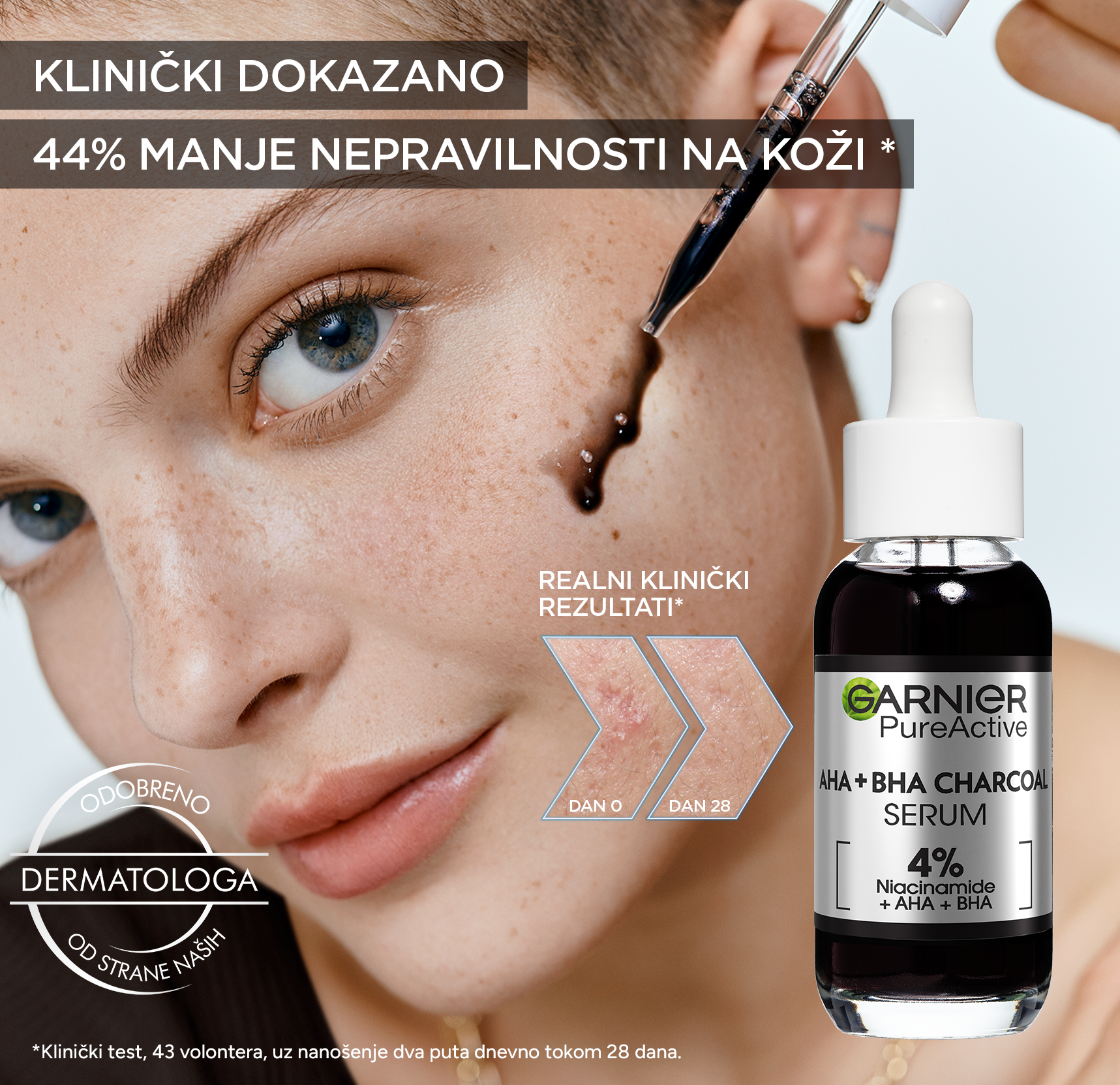 1 3 Tvoja koža je masna i sklona nepravilnostima? Otkrij utiske 99 srećnih dobitnika koji su testirali Garnier Pure Active Black serum sa klinički dokazanim efektom!