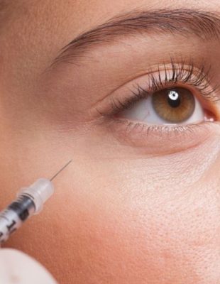 Šta je “baby botox” i po čemu se razlikuje od regularnog botoksa